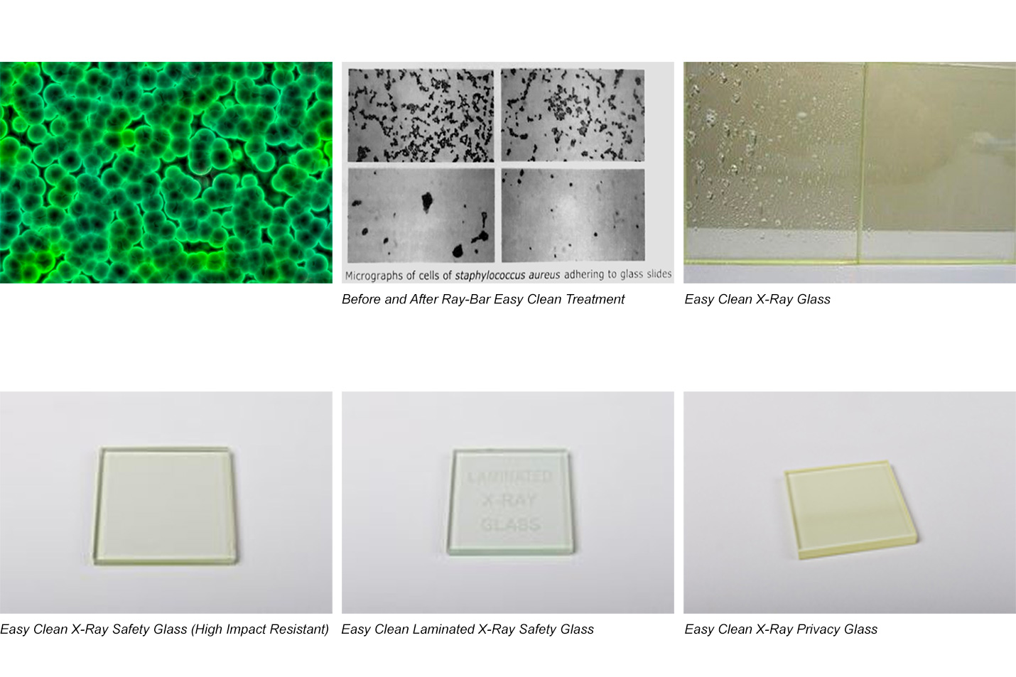 Easy-Clean X-Ray Glass provides x-ray protection from Alpha, Beta and Gamma Ionizing radiation for proper shielding of medical diagnostic imaging procedures