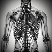 Ultrarays Radiation Shielding Materials and Fixtures